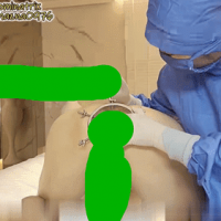 小米拳交扩肛25分