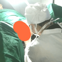 国产医疗插马眼