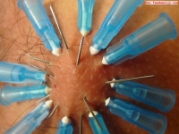 弟弟你病了，需要扎针