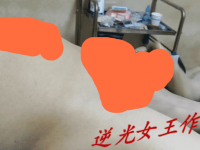 逆光，医疗穿刺，吐奶56分