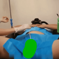 国产医疗虐肛，穿刺鸡鸡喷潮49分