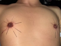 北京贱狗刑讯逼供